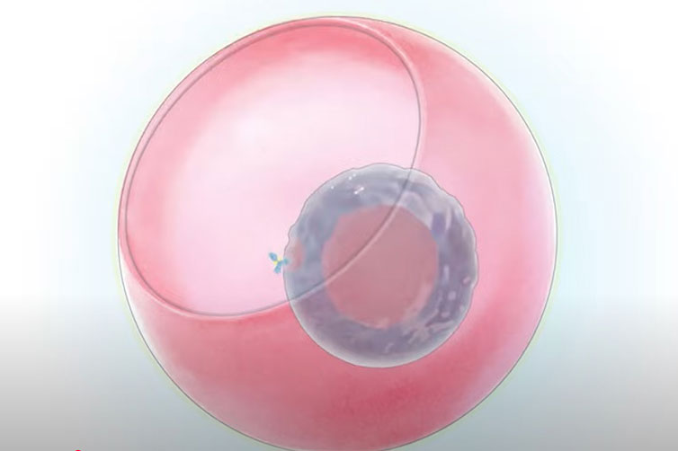 Artist rendering of a hydrogel